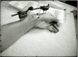 A black and white photo of a person's arm with a machine on it.